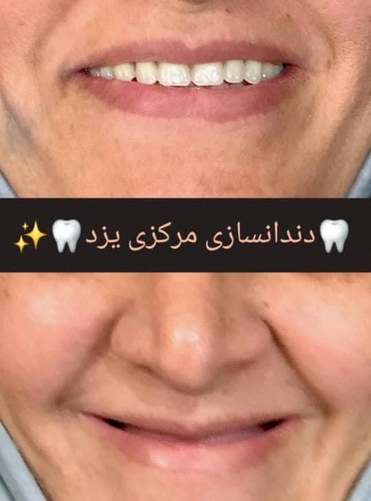 دندانسازی شکوهی یزد