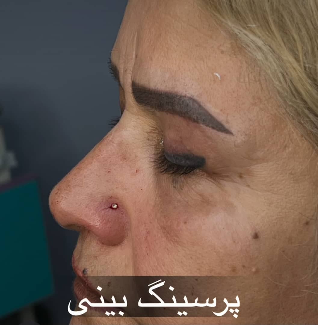 کلینیک زیبایی و لیزر دکتر عسکری در خیابان معلم رشت