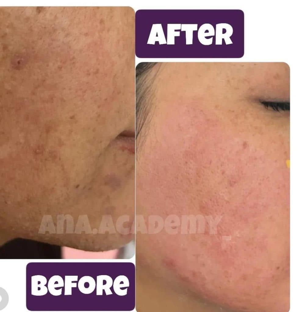 کلینیک زیبایی آنا در شیراز