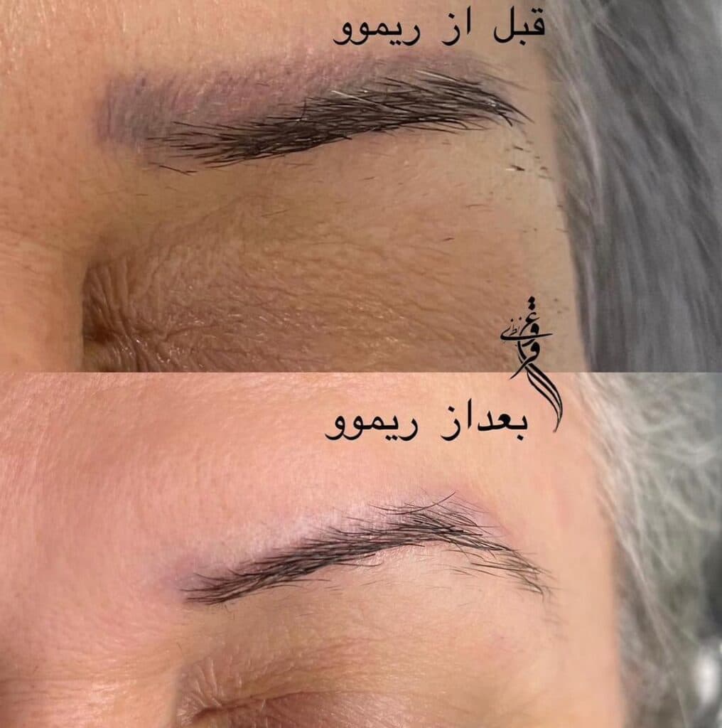 مرکز تخصصی آرایش دائم فروغ نظری در رشت