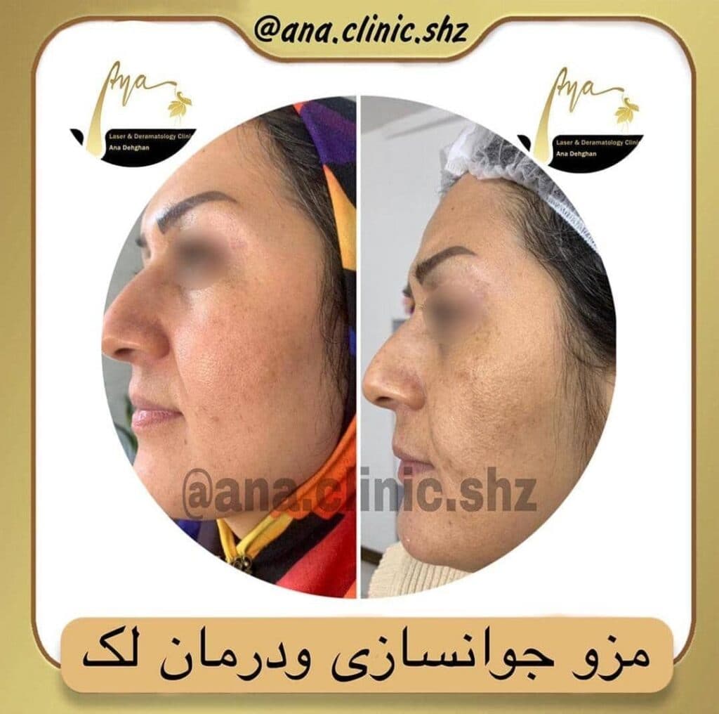 کلینیک زیبایی آنا در شیراز