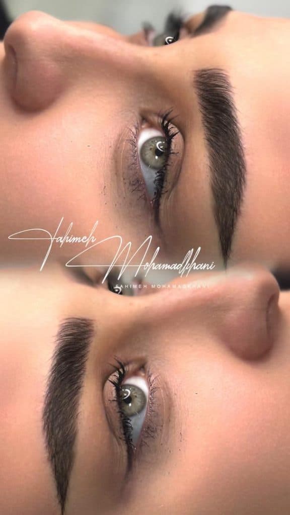 مرکز تخصصی فیبروز فهیمه محمدخانی در قزوین