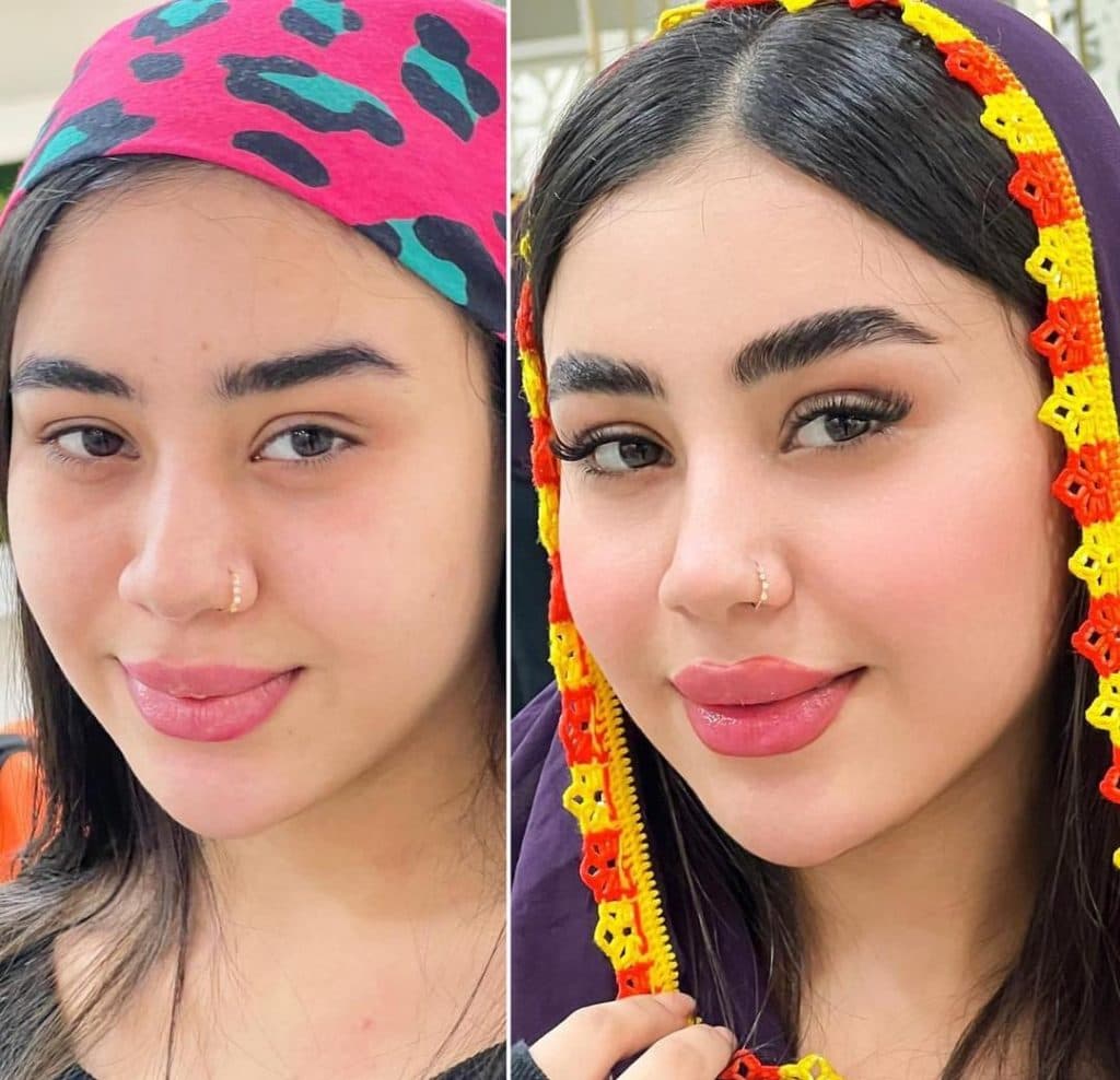 مرکز تخصصی لیفت ابرو و مژه سمانه کیانی در بندرعباس