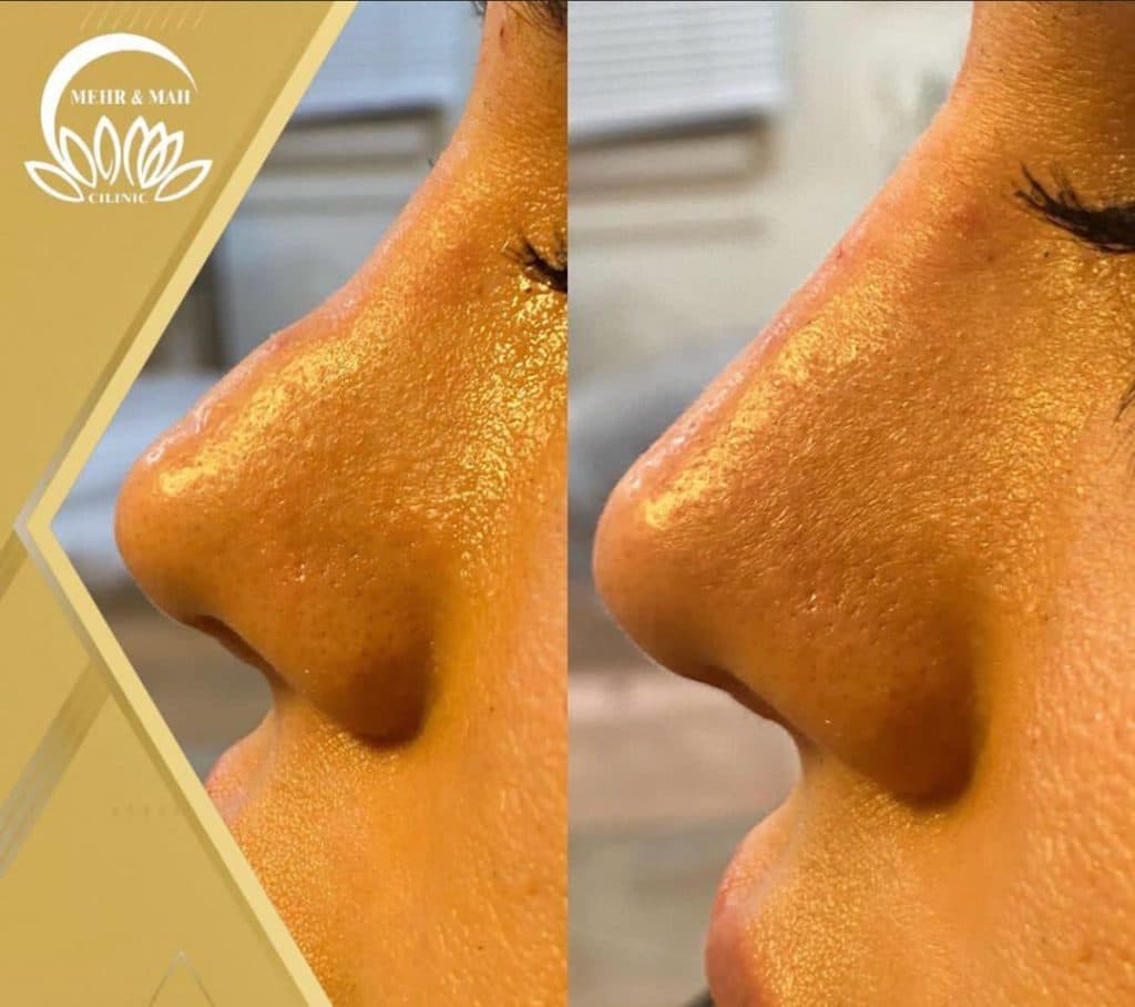 کلینیک زیبایی مهر و ماه در رشت