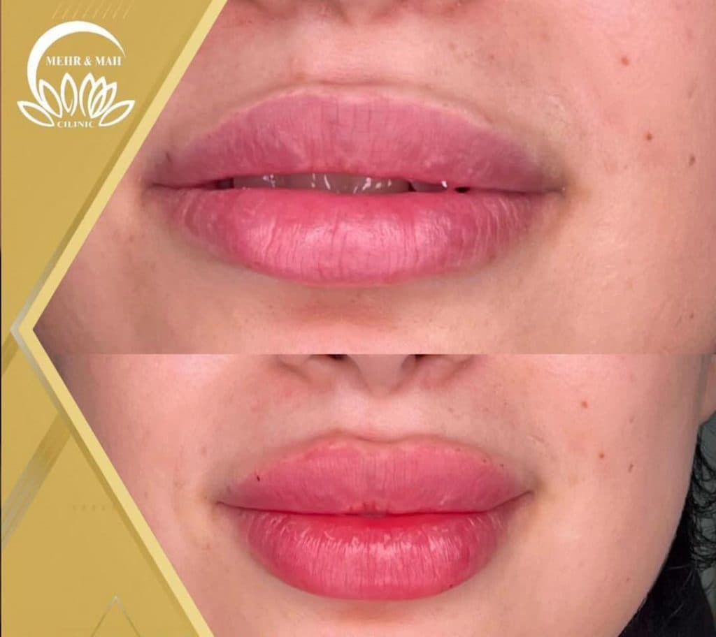 کلینیک زیبایی مهر و ماه در رشت