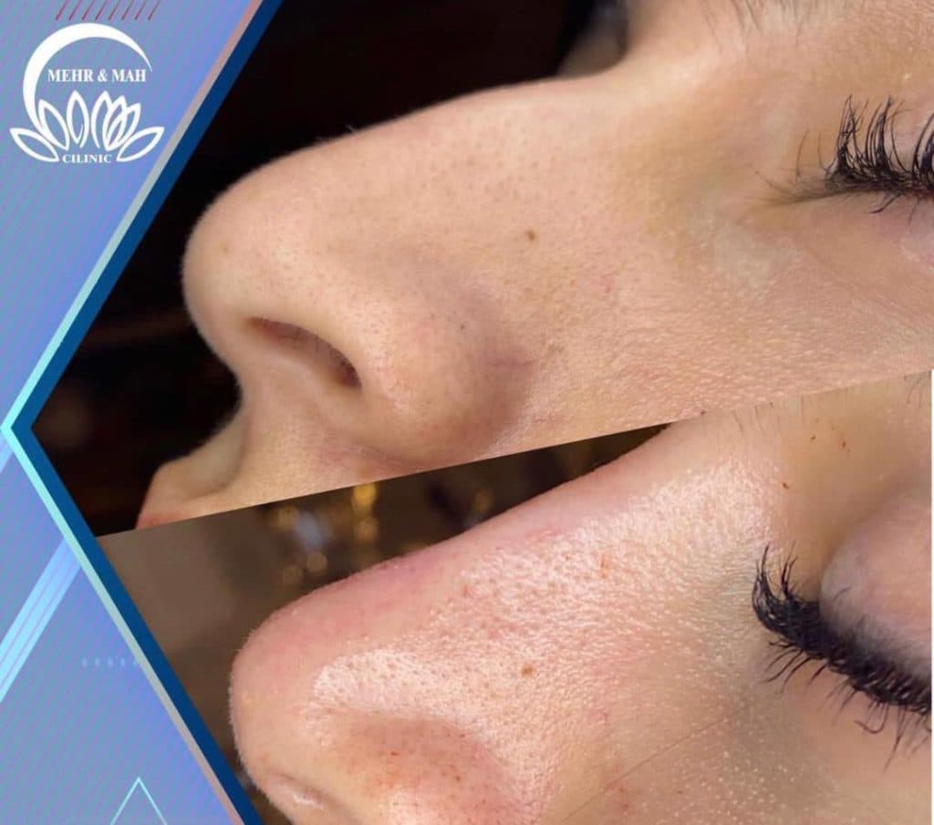 کلینیک زیبایی مهر و ماه در رشت