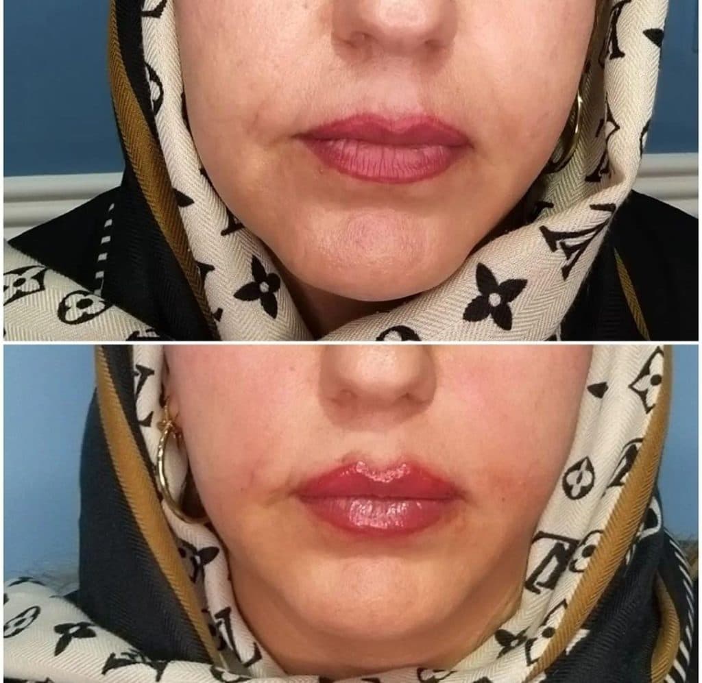 کلینیک زیبایی لیزر هایفوژل و بوتاکس برلیان در معالی آباد شیراز