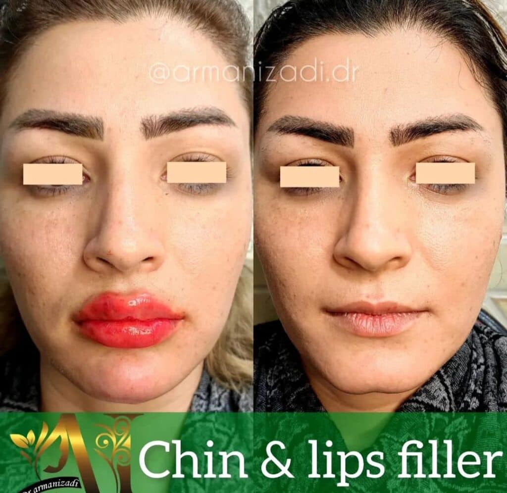 کلینیک زیبایی و خدمات زیبایی بوتاکس و ژل و لیزر دماوند در صدرا شیراز