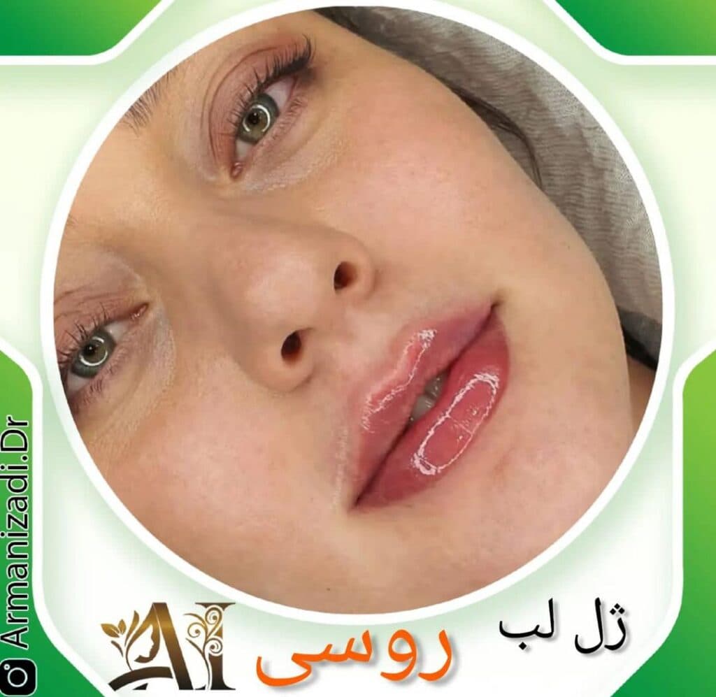 کلینیک زیبایی و خدمات زیبایی بوتاکس و ژل و لیزر دماوند در صدرا شیراز