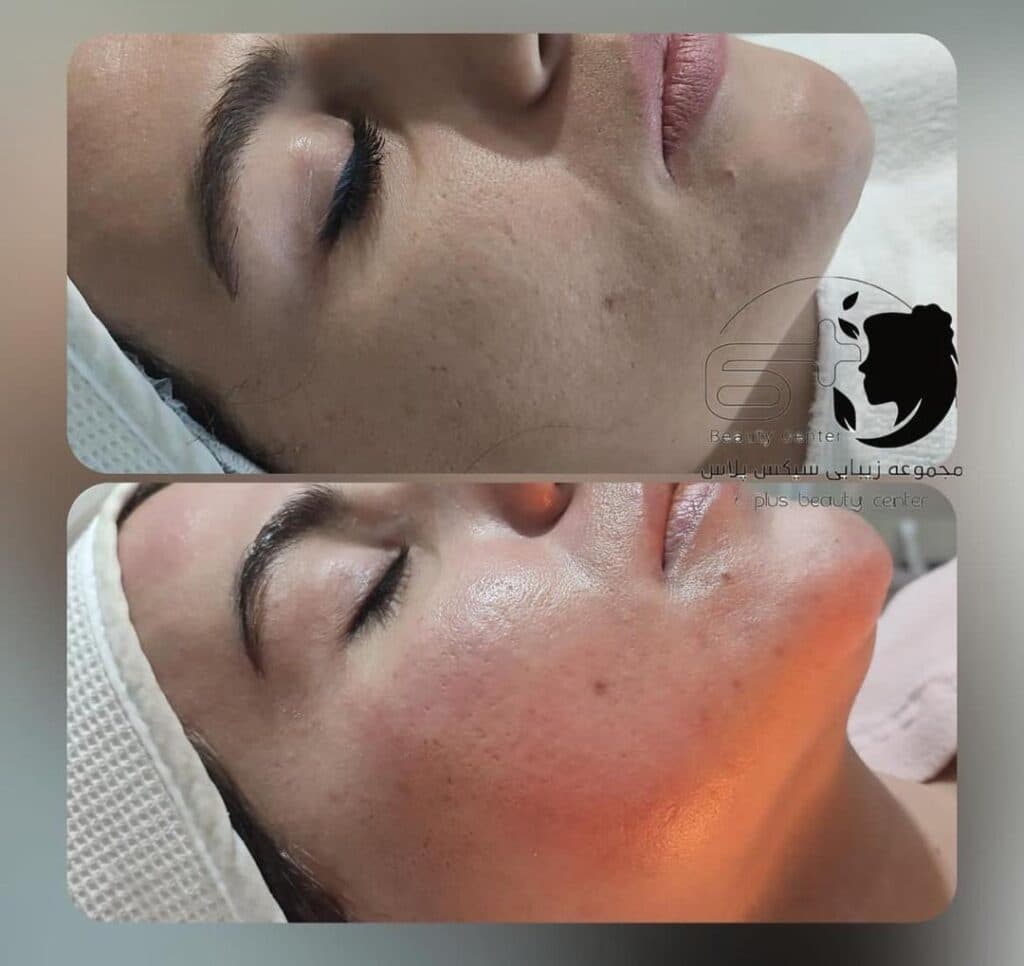کلینیک زیبایی سیکس پلاس در شیراز