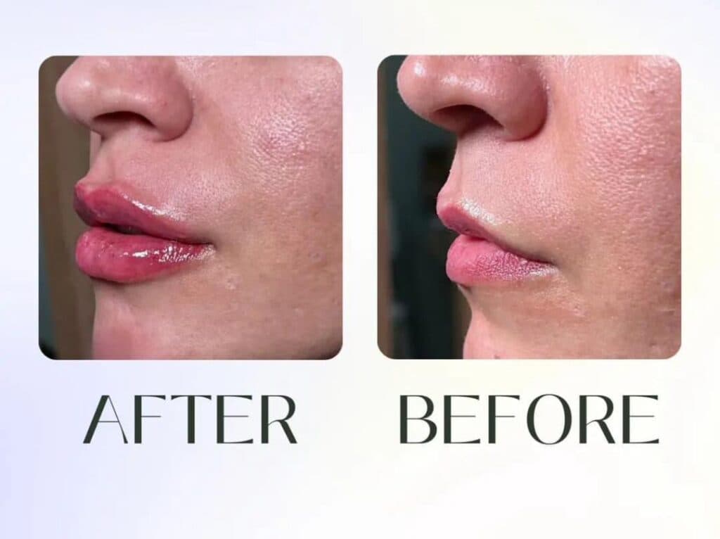 کلینیک زیبایی فلورا در مهران کرج