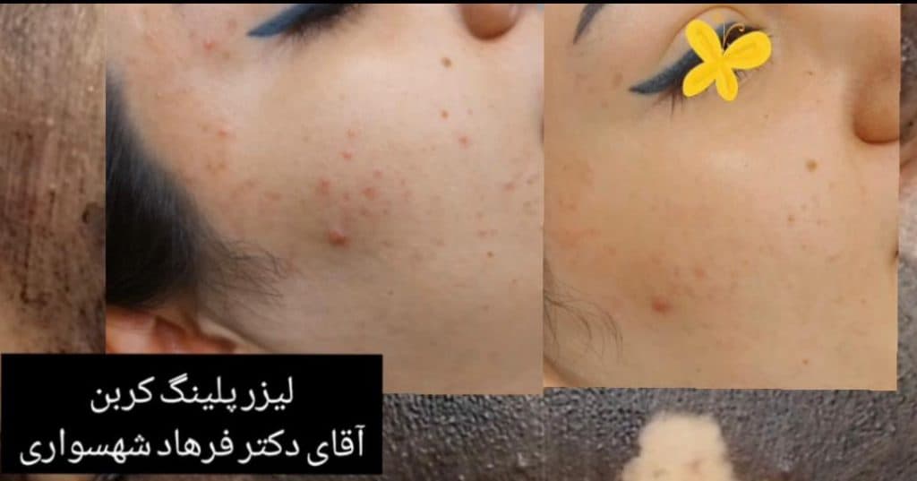 کلینیک زیبایی پوست و مو دکتر فرهاد شهسواری در عظیمیه کرج