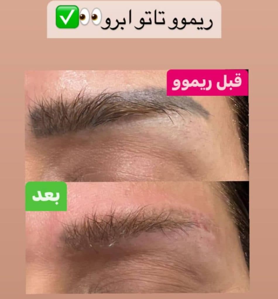 کلینیک زیبایی و لیزر موهای زائد مهتاب در رشت