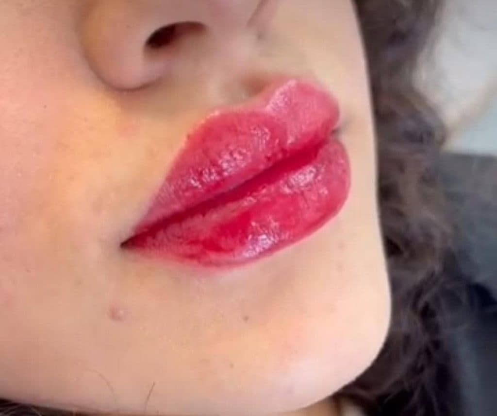 کلینیک زیبایی پوست و مو مانلی در کرج