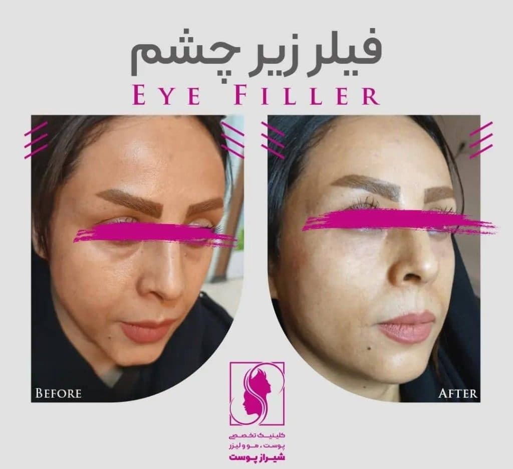 کلینیک زیبایی پوست و مو شیراز پوست زارع در شیراز