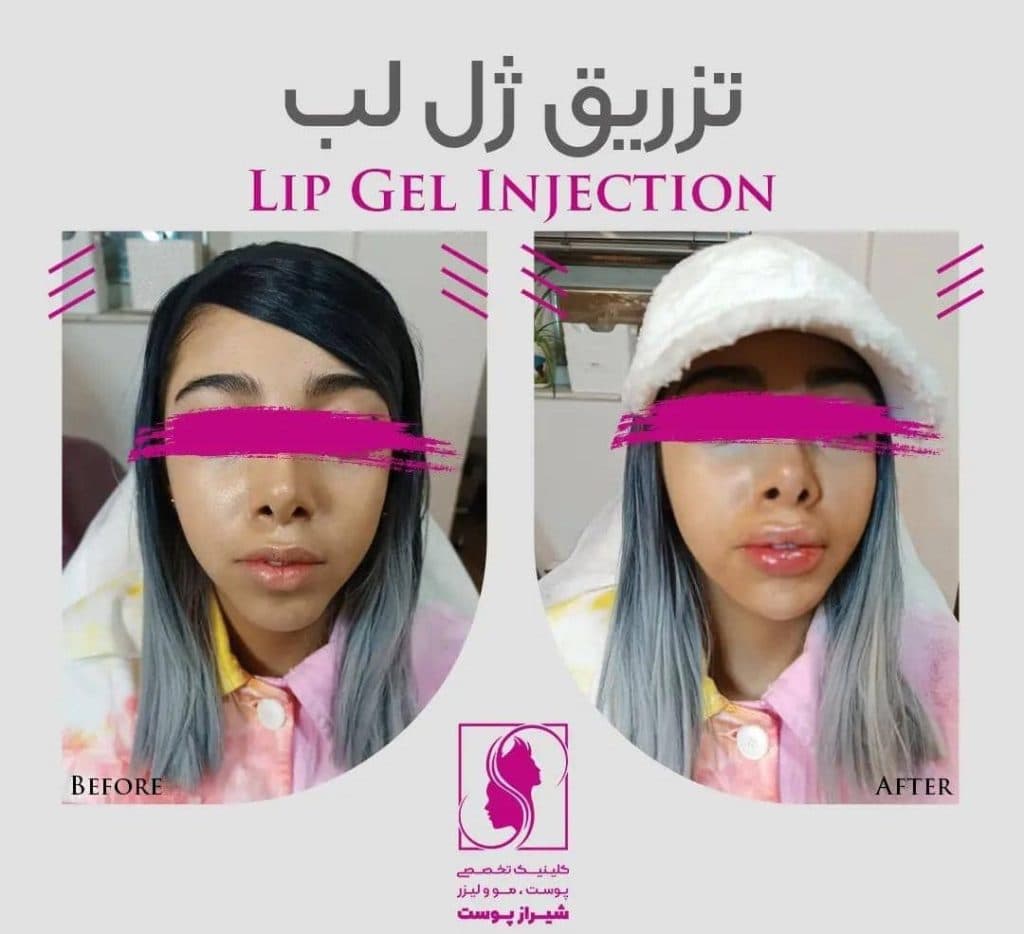 کلینیک زیبایی پوست و مو شیراز پوست زارع در شیراز