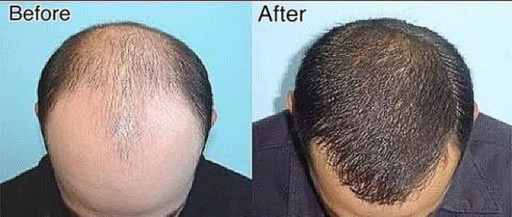 کلینیک زیبایی پوست و مو بهتا در کرج