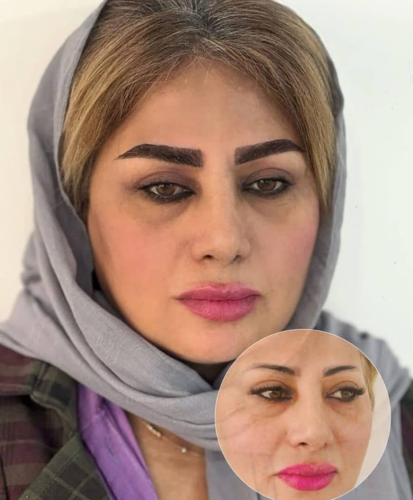 کلینیک زیبایی پوست و مو بهتا در کرج