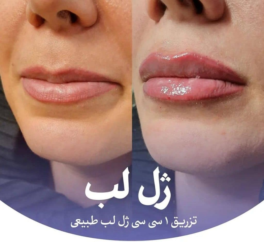 کلینیک زیبایی و لیزر تندیس در باغستان غربی کرج