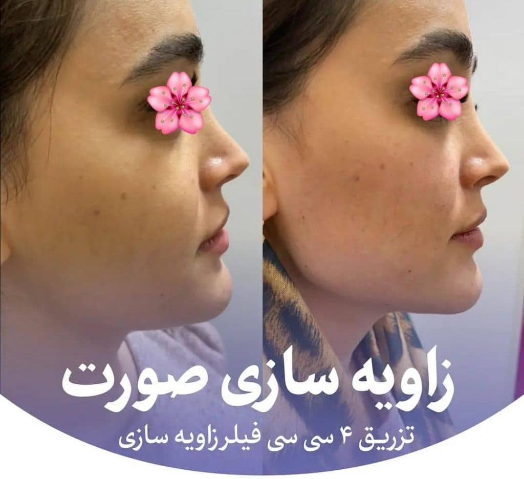 کلینیک زیبایی و لیزر تندیس در باغستان غربی کرج