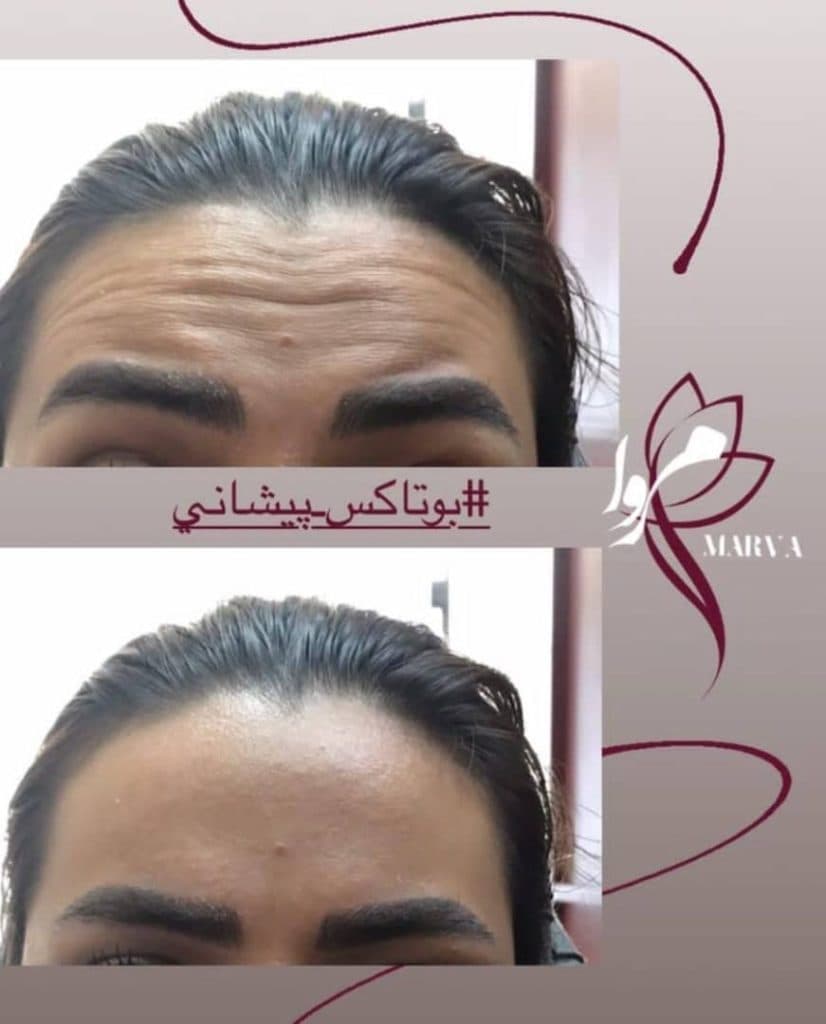 کلینیک زیبایی پوست و مو مروا در کرج