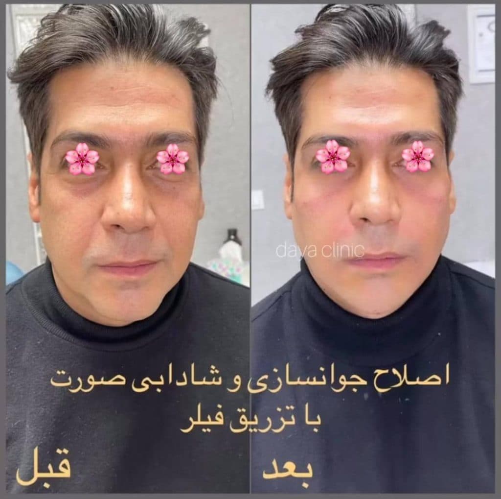 کلینیک زیبایی پوست و مو دایا در کرج