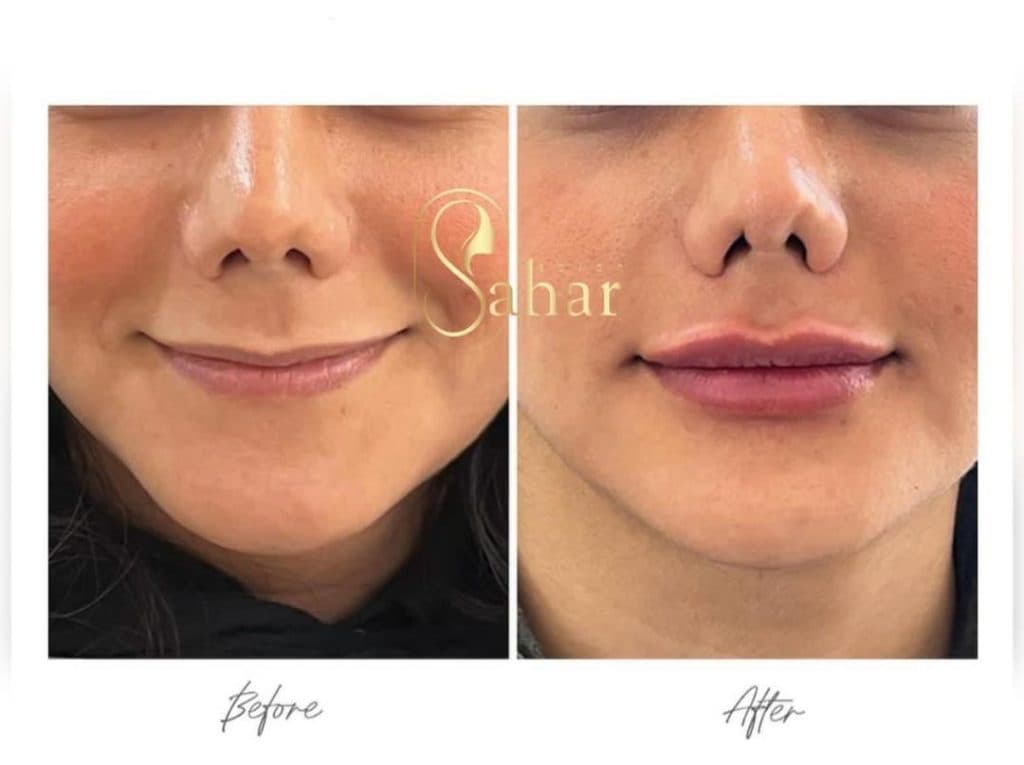 کلینیک زیبایی سحر در قریشی شمالی فردیس کرج