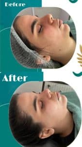 خدمات زیبایی و فیشیال پوست مهسا عبدالعلی زاده در تهران