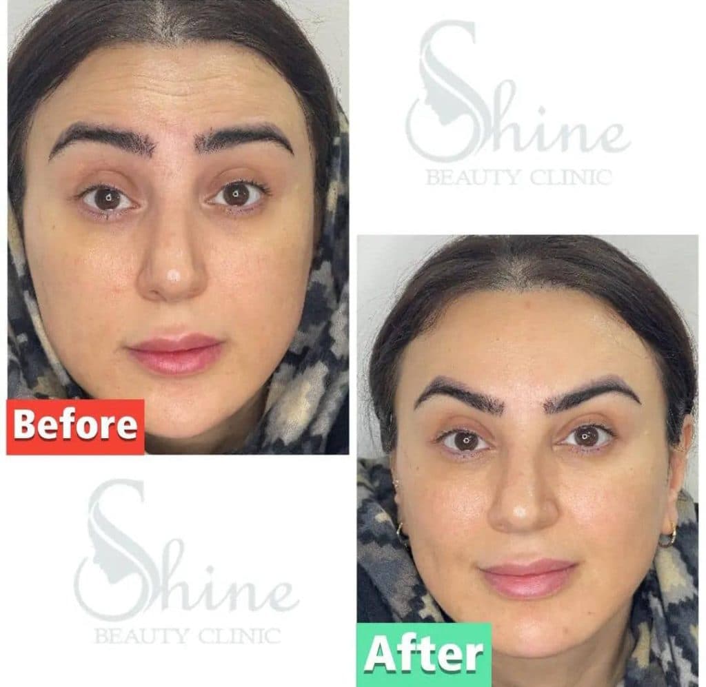 کلینیک زیبایی پوست و مو شاین در مجیدیه تهران