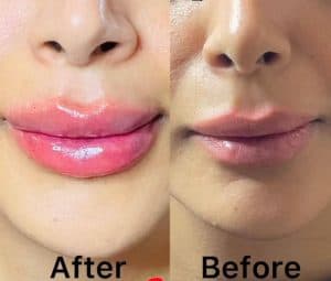 کلینیک زیبایی پوست و مو شاین در مجیدیه تهران