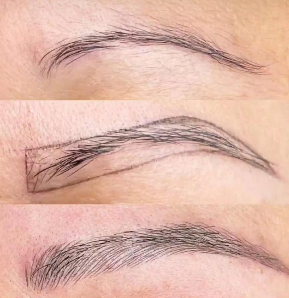 خدمات تخصصی میکروبلیدینگ شاپرک در بلوار سیمون بولیوار تهران