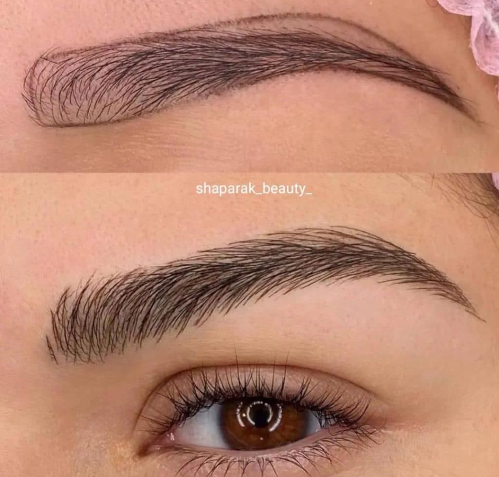 خدمات تخصصی میکروبلیدینگ شاپرک در بلوار سیمون بولیوار تهران