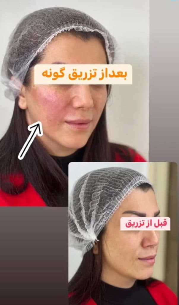 مطب زیبایی و لیزر دکتر طلوع هدایتی رشت