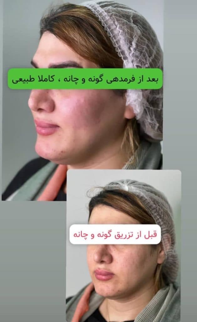مطب زیبایی و لیزر دکتر طلوع هدایتی رشت