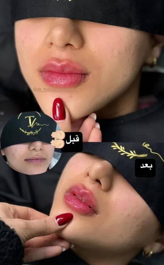 مطب زیبایی و لیزر دکتر طلوع هدایتی رشت