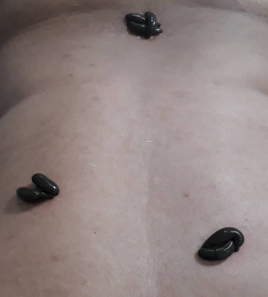 خدمات طب سنتی عامری در گلستان اهواز