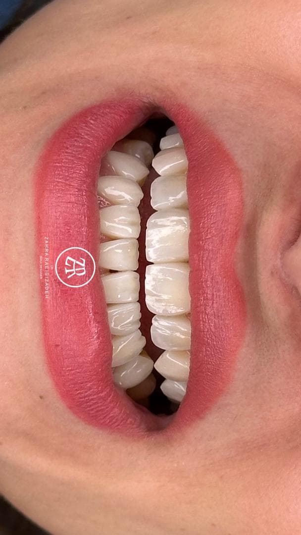 دندانپزشکی تخصصی ترمیم و زیبایی دکتر زهرا رئیسی زاده در جردن تهران