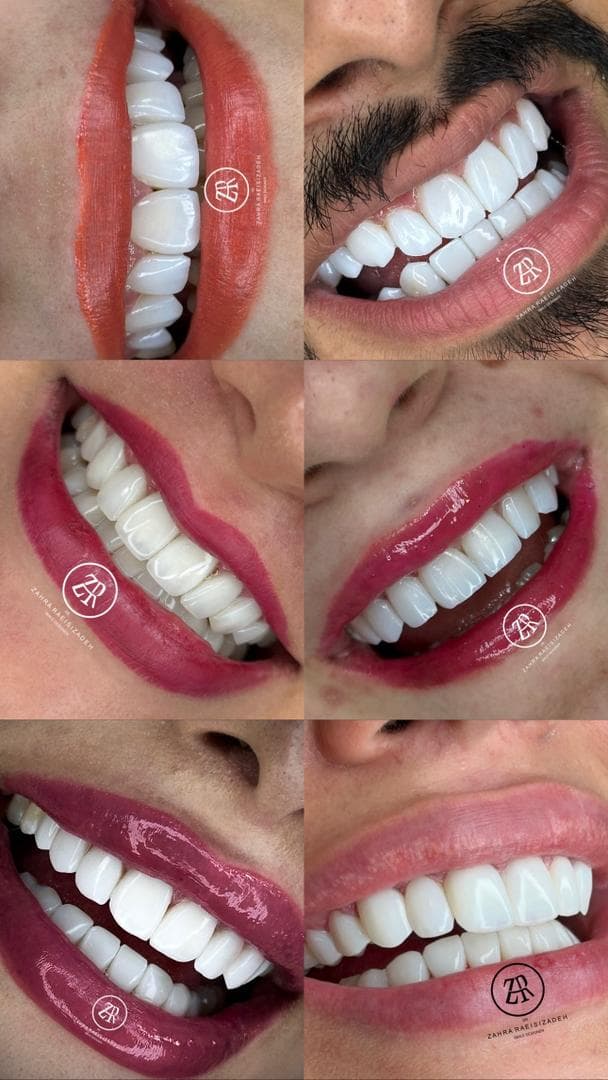 دندانپزشکی تخصصی ترمیم و زیبایی دکتر زهرا رئیسی زاده در جردن تهران