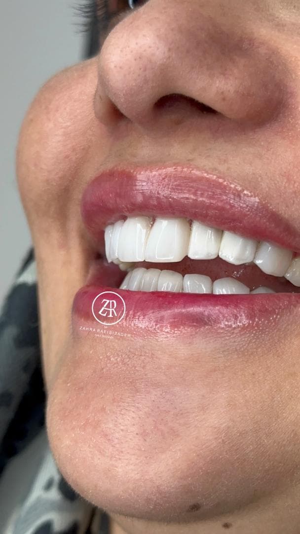 دندانپزشکی تخصصی ترمیم و زیبایی دکتر زهرا رئیسی زاده در جردن تهران