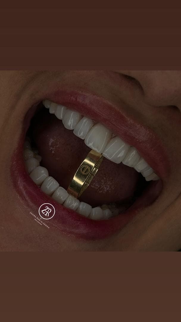 دندانپزشکی تخصصی ترمیم و زیبایی دکتر زهرا رئیسی زاده در جردن تهران