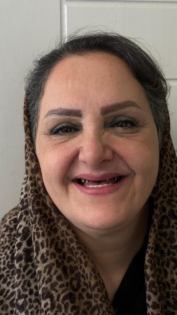 دندانپزشکی تخصصی ترمیم و زیبایی دکتر زهرا رئیسی زاده در جردن تهران