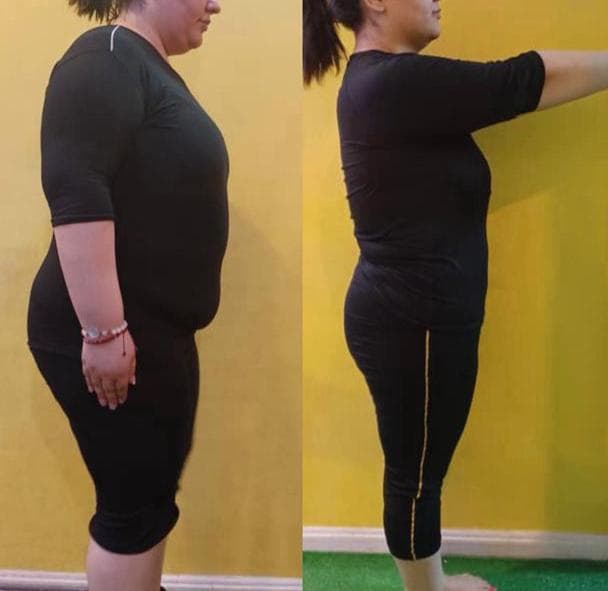 ایکس بادی لاغری ems در ونک و فرشته تهران