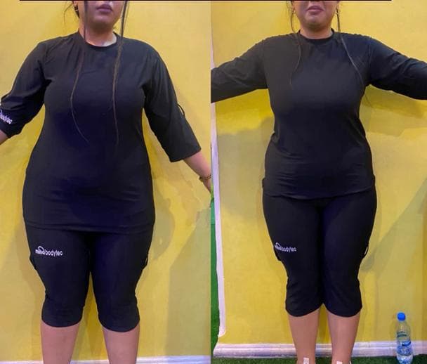 ایکس بادی لاغری ems در ونک و فرشته تهران