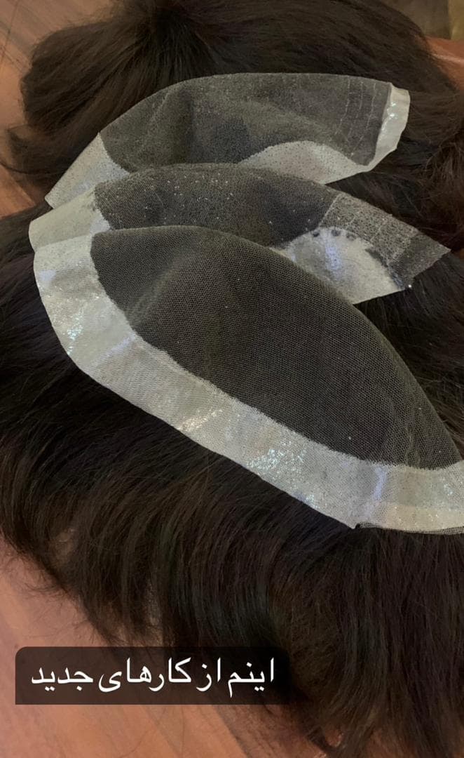 تولید عمده پروتز مو طبیعی جلوسری بالاسری تمام سری gilan wig تهران