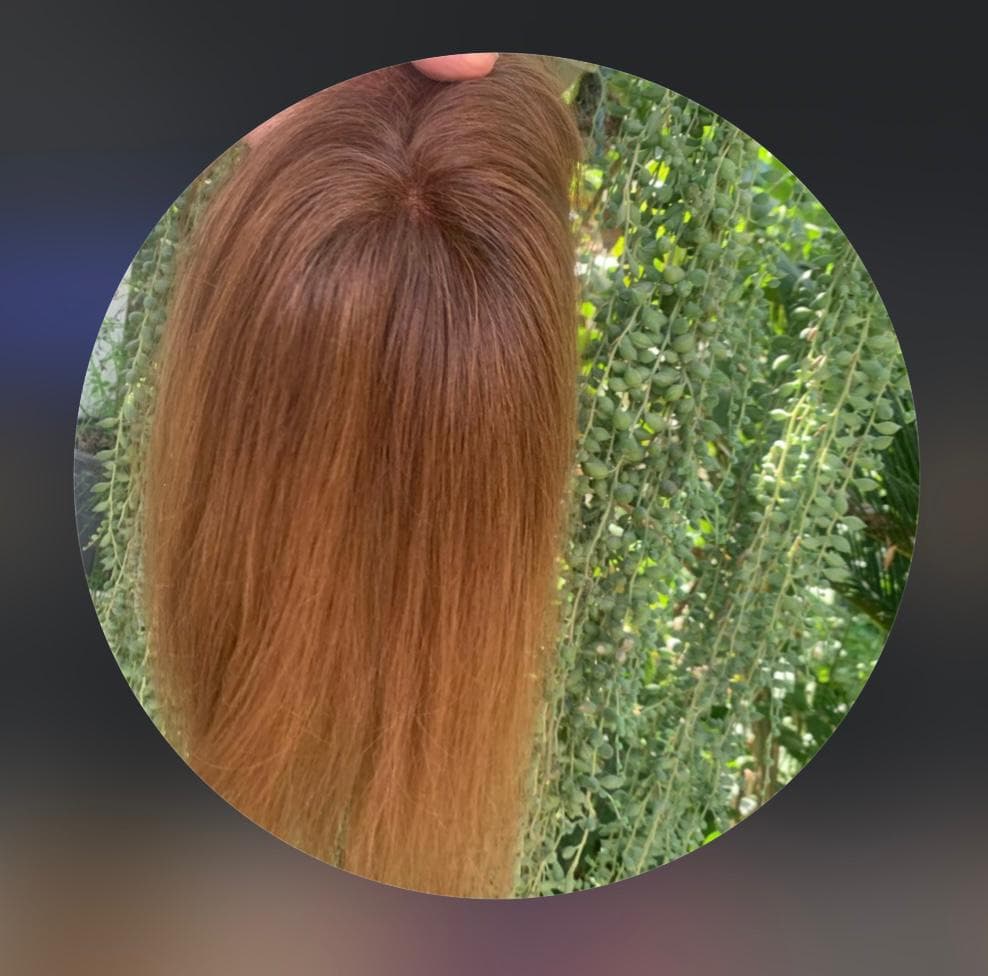 تولید عمده پروتز مو طبیعی جلوسری بالاسری تمام سری gilan wig تهران