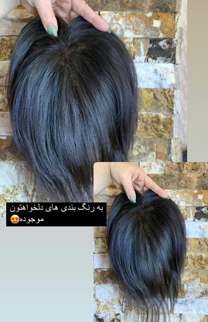 تولید عمده پروتز مو طبیعی جلوسری بالاسری تمام سری gilan wig تهران
