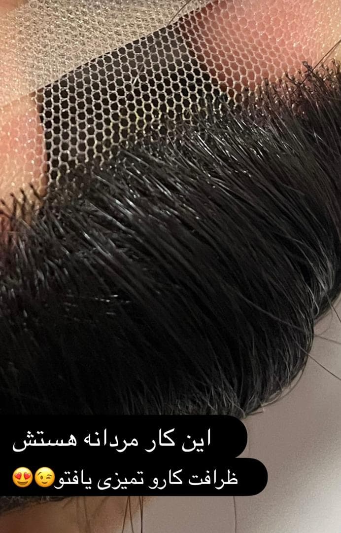 تولید عمده پروتز مو طبیعی جلوسری بالاسری تمام سری gilan wig تهران