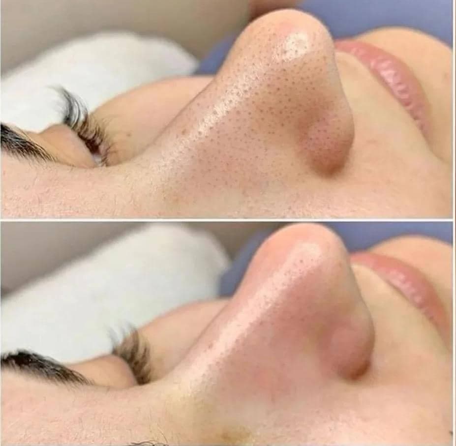 مرکز پاکسازی پوست و زیبایی الهام تقوی در امیدیه