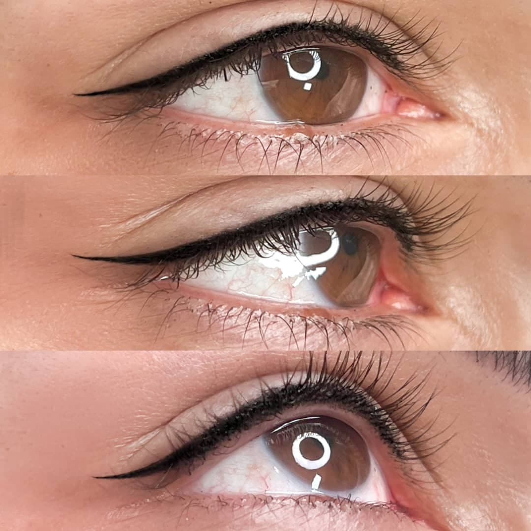 مرکز تخصصی میکروبلیدینگ و میکروپیگمنتیشن رعنا واحدی لاهیجان