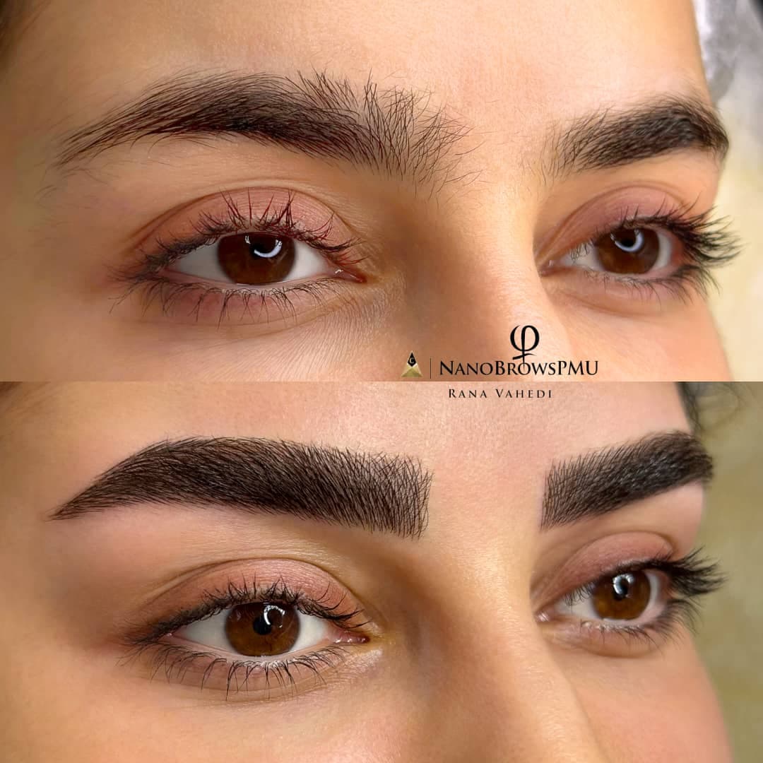 مرکز تخصصی میکروبلیدینگ و میکروپیگمنتیشن رعنا واحدی لاهیجان